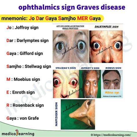 Ophthalmic Sign in Graves disease – MedicoLearning