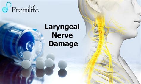 Laryngeal Nerve Damage - Premilife - Homeopathic Remedies