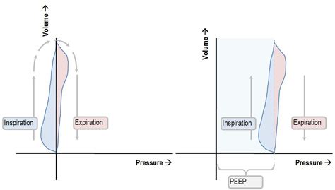 Interpreting the shape of the pressure-volume loop | Deranged Physiology