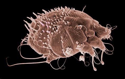 Scabies Mite Photograph by Natural History Museum, London/science Photo Library - Pixels