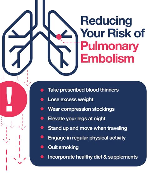 Pulmonary Embolism: How to Reduce Your Risk – The Amino Company