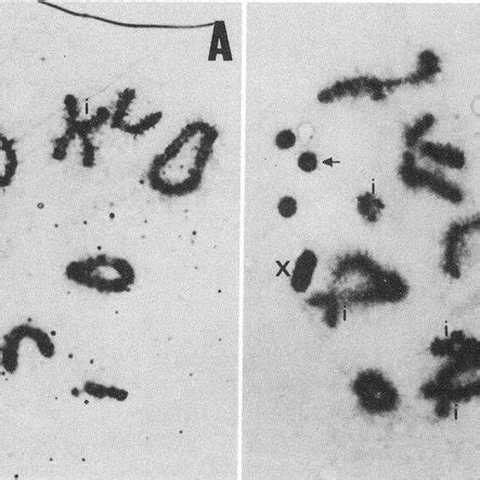 -Diplotene cells free (A) and carrying three B chromosomes (B; arrow ...