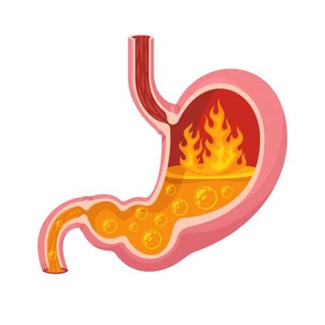 Not the Bad Guy: The Importance of Stomach Acid