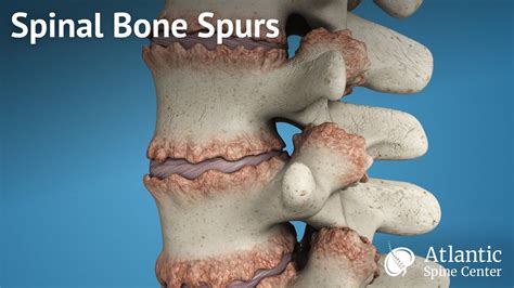 [DIAGRAM] Diagram Of Spine - MYDIAGRAM.ONLINE