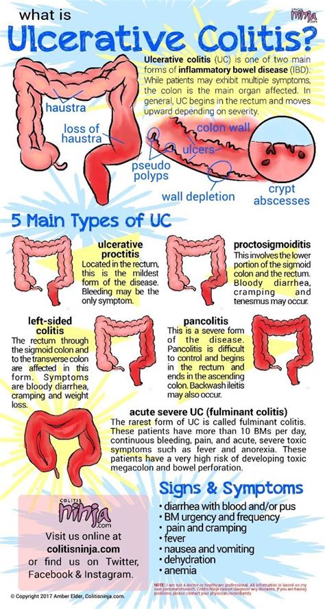 Pin on Ulcerative Colitis