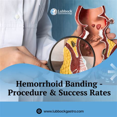 Hemorrhoid Banding Lubbock, TX- Procedure & Success Rates