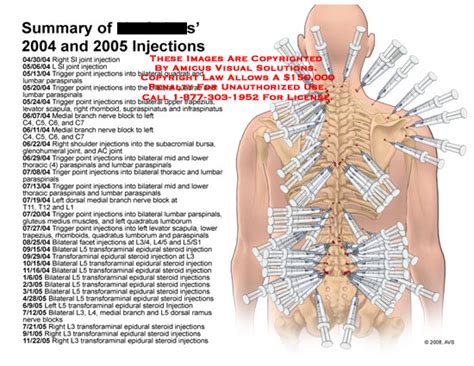 Summary of Injections