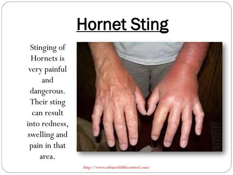 PPT - What To Do For a Hornet Sting? PowerPoint Presentation, free ...