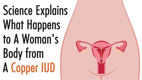 Science Explains What Happens to A Woman's Body From A Copper IUD