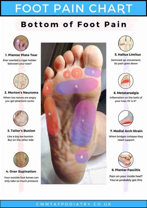 Foot Pain Chart - Bottom of Foot Pain Download Printable PDF | Templateroller