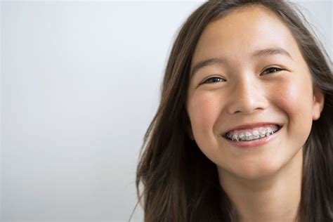 Affordable Braces Dentist in Las Vegas | Orthodontics Las Vegas