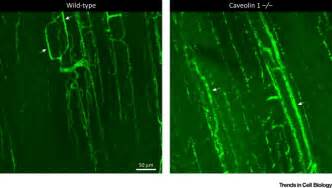 Caveolae: One Function or Many?: Trends in Cell Biology