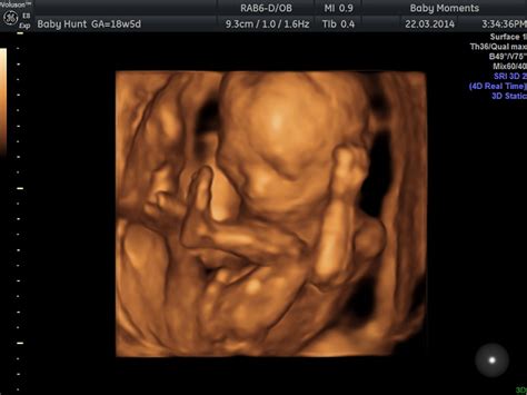 15 Mins Mini Wellbeing Scan - Baby Moments 3D 4D ultrasound Scan Centre ...