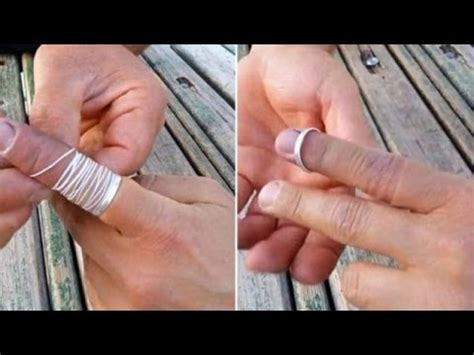 Genius trick to remove ring stuck on swollen finger! | Latest News ...