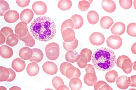 Neutrophils In Peripheral Blood Smear by M. I. Walker