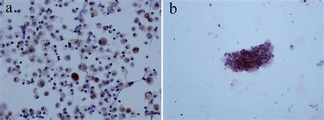 a CMV immunocytochemistry show "owl's-eye" like structure. CMV-IHCx40.... | Download Scientific ...