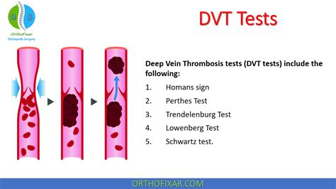 Deep Vein Thrombosis, DVT Symptoms, Causes And, 42% OFF