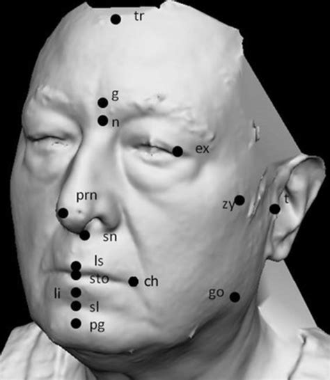 Soft tissue facial landmarks used in the current study: tr, trichion ...