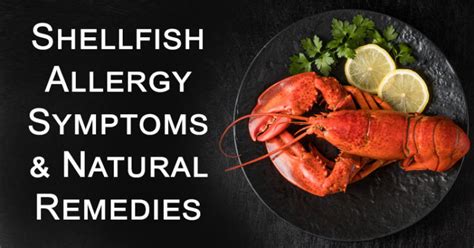 Common Shellfish Allergy Symptoms & Natural Remedies - David Avocado Wolfe