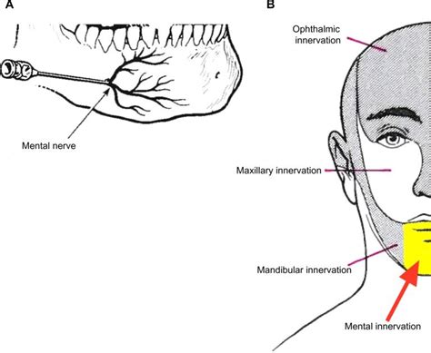 Anatomy and innervation of the mental nerve. Notes: The mental nerve is... | Download Scientific ...