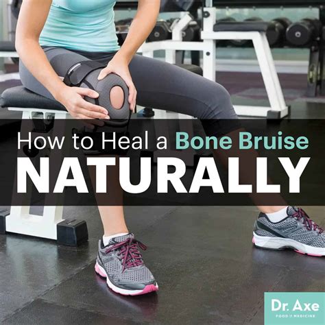 How to Heal a Bone Bruise Naturally - Dr. Axe