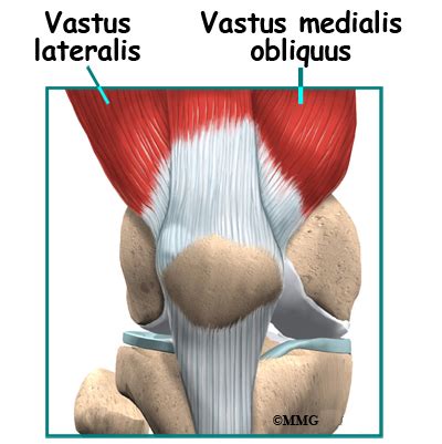 Chondromalacia Patella - eOrthopod.com