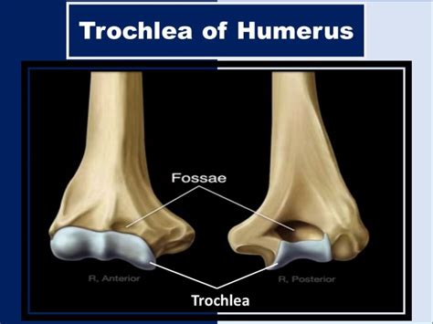 Trochlea of Humerus, Femur, Eye, & Other Areas | Health Kura