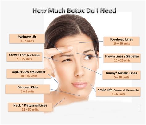 Botox Dosage Chart - Can I Get Botox On My Face - Free Transparent PNG ...