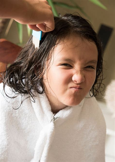 Best shampoo For Lice: Say Goodbye To Lice With Top 7 Brands!