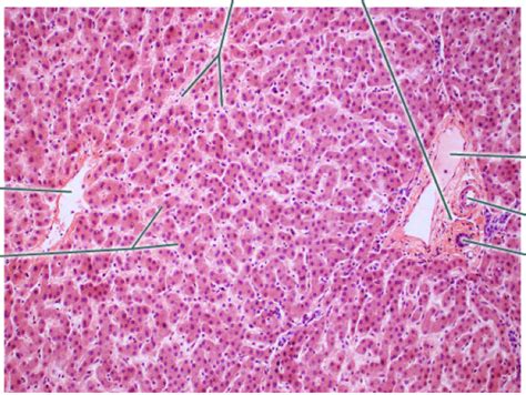 liver histology 100x (Lobule) Diagram | Quizlet