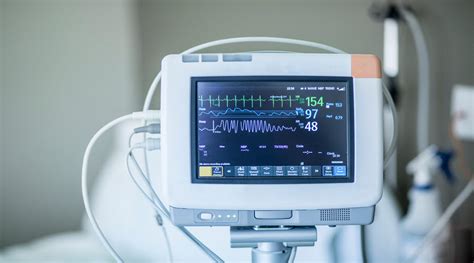 Optimizing Supply Chain process for a large Hospital Chain (with over 30 hospitals)