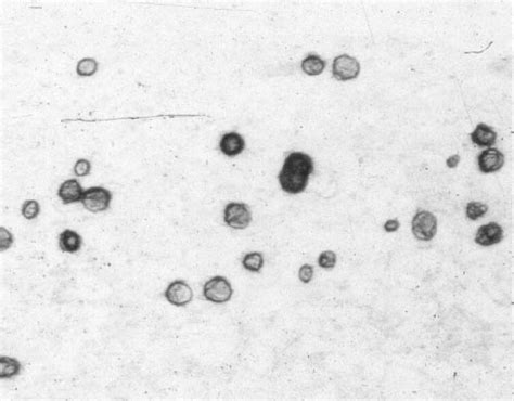 Colonies of Ureaplasma spp. growing on A8 agar after 48 h of incubation ...