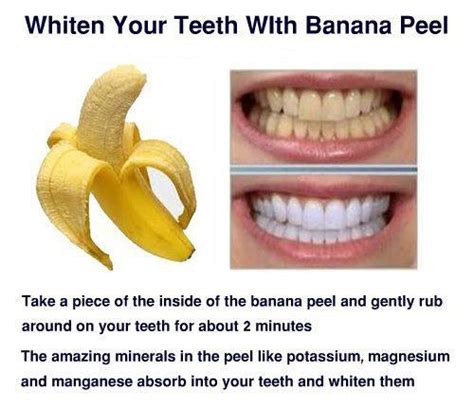 Is banana peel teeth whitening effective? | News | Dentagama