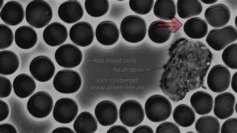 Pin on Immune System Cells Under a Microscope