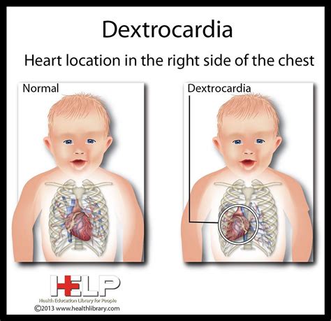 Embracing My Unique Difference: A Journey as a Dextrocardian | by Tony ...