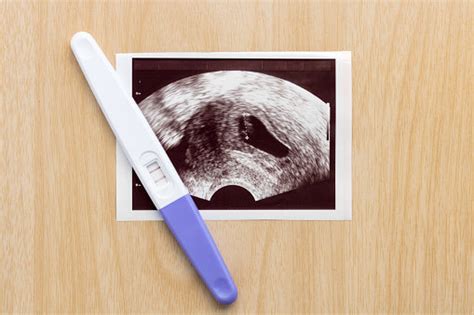 First Ultrasound - What to Expect at Your First Prenatal Exam – The ...