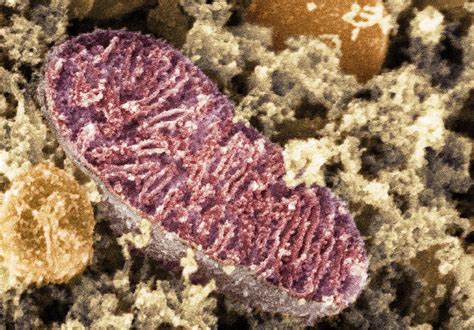 Mitochondrion, Sem Photograph by Dr David Furness, Keele University