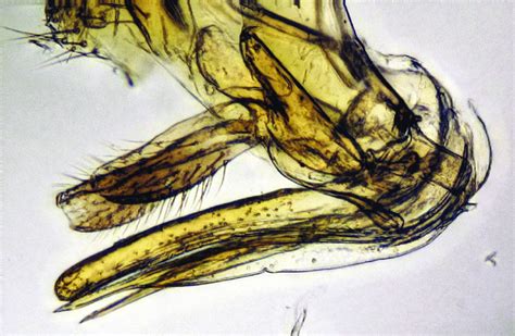 Cleared dissection of ovipositor apparatus. | Download Scientific Diagram