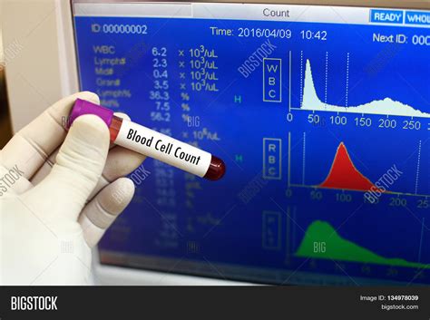 Test Tube Blood Sample Image & Photo (Free Trial) | Bigstock