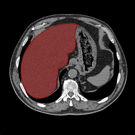 What is a Liver CT scan? | Two Views