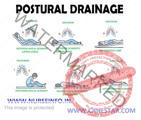 POSTURAL DRAINAGE - Nurse Info