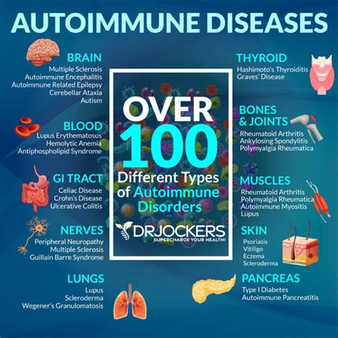 The 7 Major Factors Causing AutoImmune Conditions