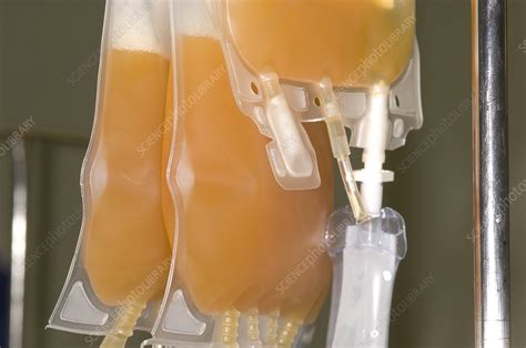 Blood platelets for transfusion - Stock Image - C005/6484 - Science ...