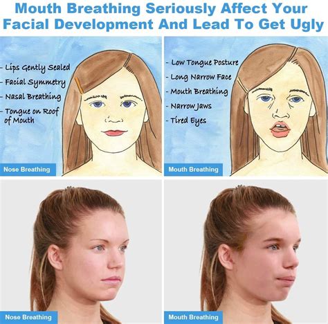 Mouth-breathing vs Nose-breathing: Effects on Face, Teeth, Jawline | How to Stop Mouthbreathing