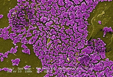 Free picture: numerous, clumps, methicillin, resistant, staphylococcus, aureus, bacteria ...