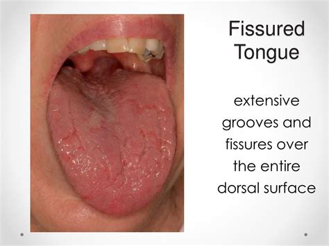 PPT - Differential Diagnosis of Oral and Maxillofacial Diseases for the ...