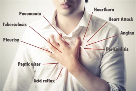 Can a Neck Problem Cause Pain in the Chest? » Scary Symptoms