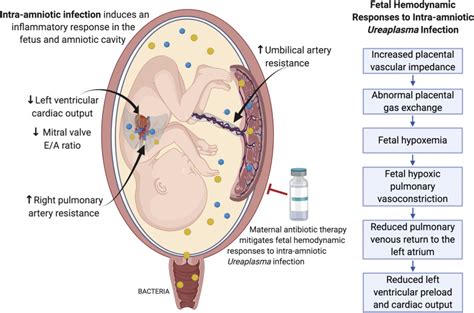 Maternal azithromycin therapy for Ureaplasma parvum intraamniotic ...