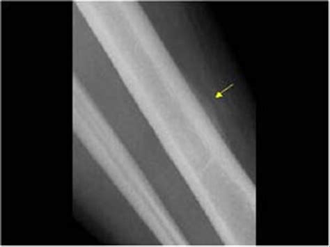 Musculoskeletal, bone, muscle, nerves and other soft tissues | 7.1 Bone : Case 7.1.5 Trauma ...