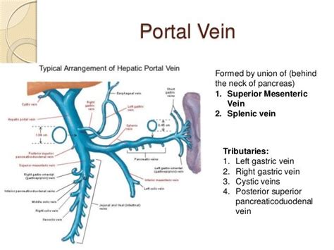 Portacaval Anastomosis